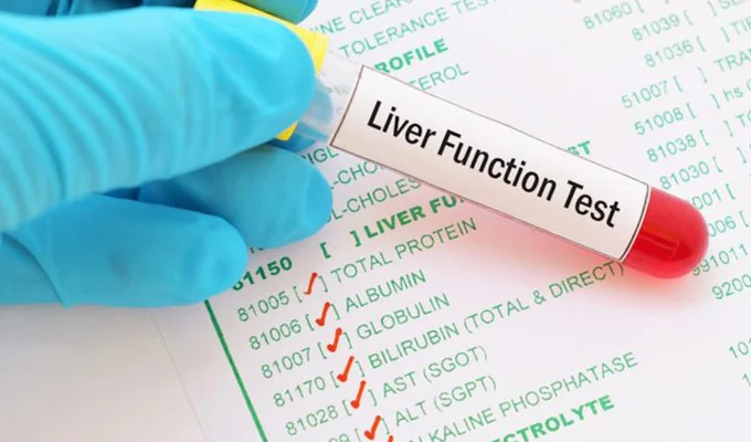 Liver Function Test (LFT)
